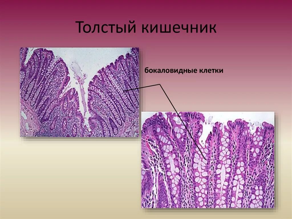 Ткани толстой кишки. Бокаловидные клетки тонкой кишки. Бокаловидная клетка гистология. Бокаловидные клетки тонкого кишечника. Бокаловидные клетки толстой кишки гистология.