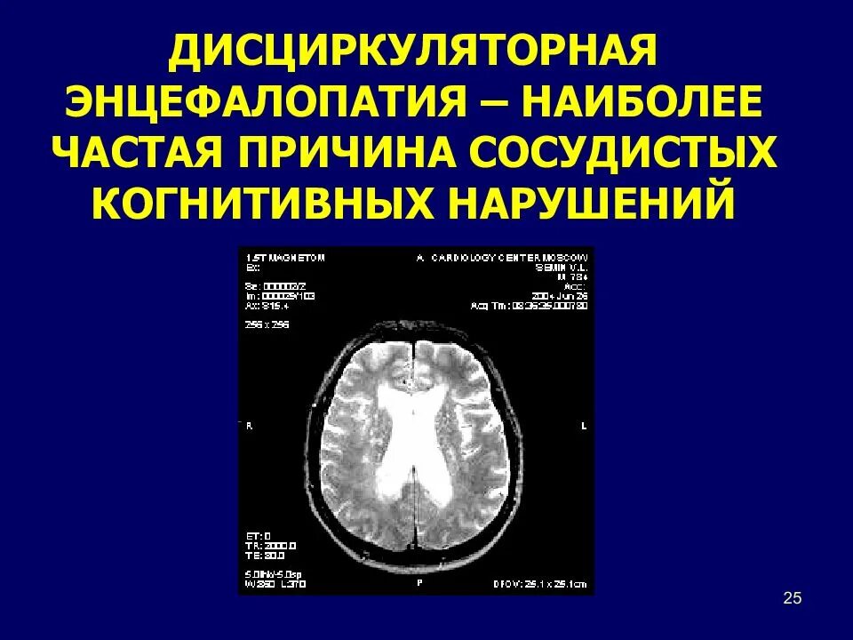 Дисциркуляторная энцефалопатия. Дисциркуляторная энцефалопатия когнитивные нарушения. Энцефалопатия с когнитивными нарушениями. Дисциркуляторная энцефалопатия на кт. Дисциркуляторные дистрофические изменения