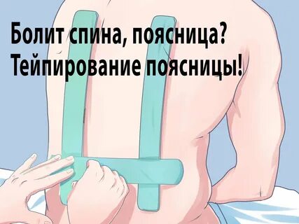 Тейпирование седалищного нерва схема