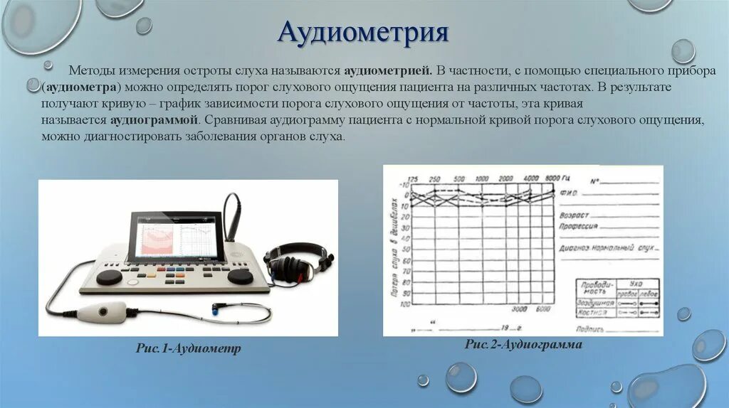 Лабораторная работа определение остроты слуха. Аудиометрия это метод определения остроты слуха. Аудиометрия является методом исследования. Аудиометр для аудиометрии. Тональная аудиометрия с тестом Вебера что это.