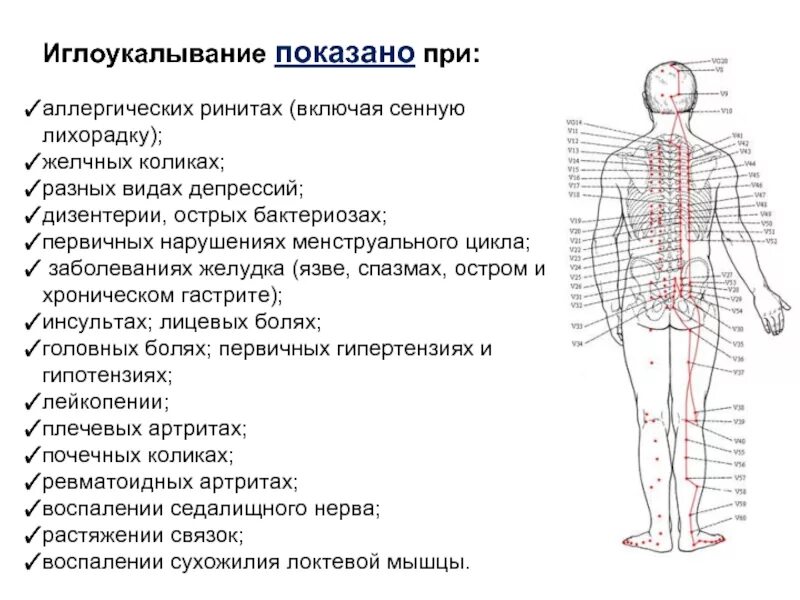Как часто можно иглоукалывание. Иглорефлексотерапия показания. показание акупунктуры. иглоукалывание схема. иглорефлексотерапия при инсульте.