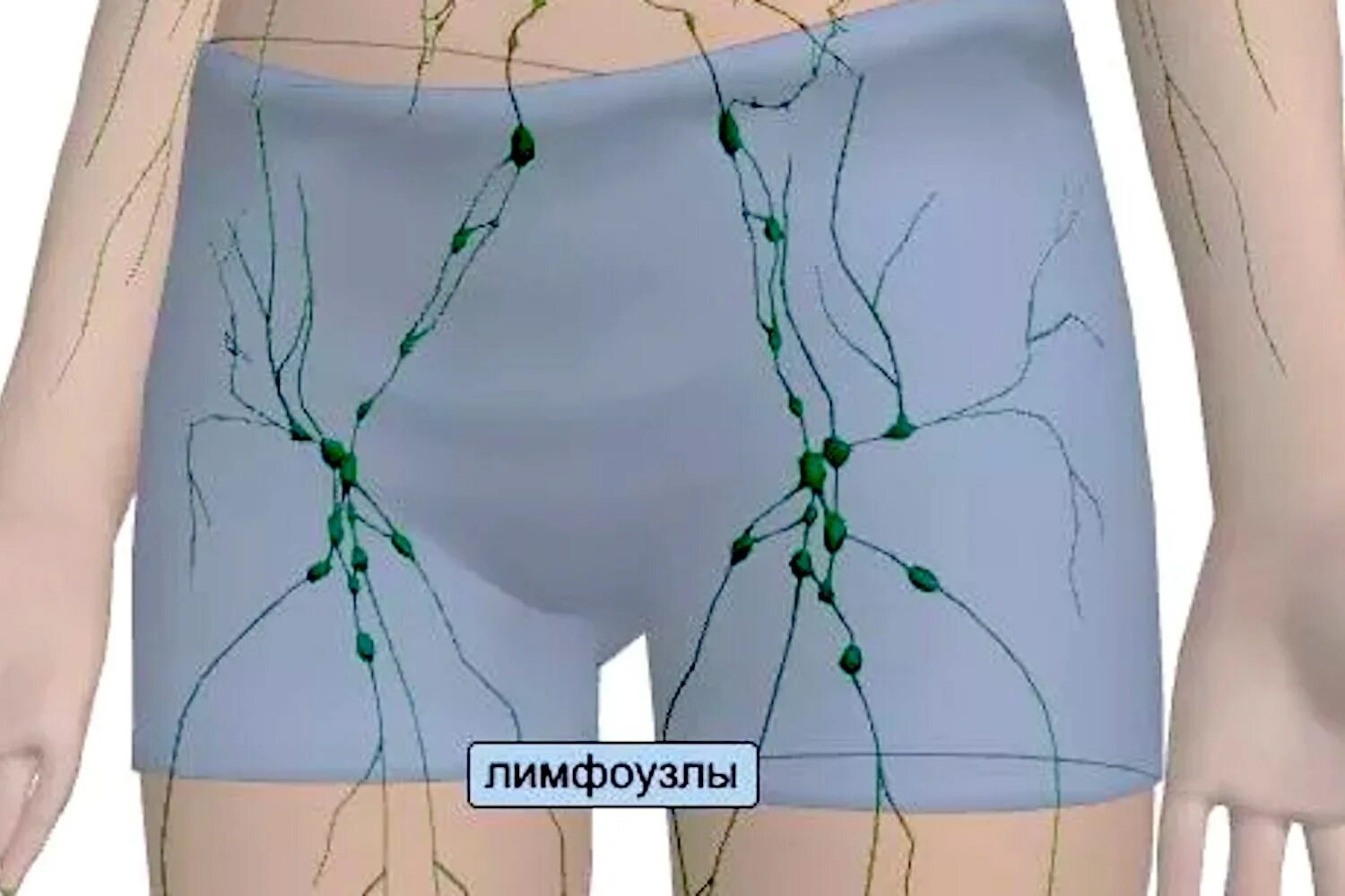 Пахово бедренные лимфоузлы. Лимфатическая система члена. Паховые лимфоузлы расположение. Паховые лимфоузлы воспаление. Лимфоузлы и удаление матки
