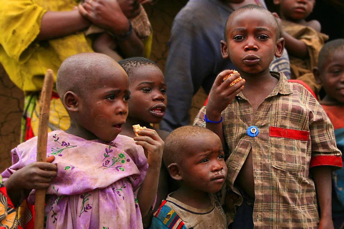 Голод страны. Голодающие дети Африки третий мир. Для детей в развивающихся странах.