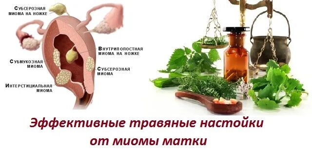 Миоме можно пить. Народные средства от миомы. народные средства при миоме матки. настойка от миомы матки. питание при миоме матки продукты.