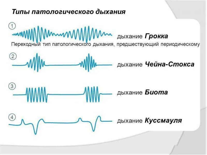 Дыхательные методики. Когерентные состояния в квантовой механике. Дыхание чейна стокса. Когерентное дыхание. Дыхание куссмауля биота чейна.
