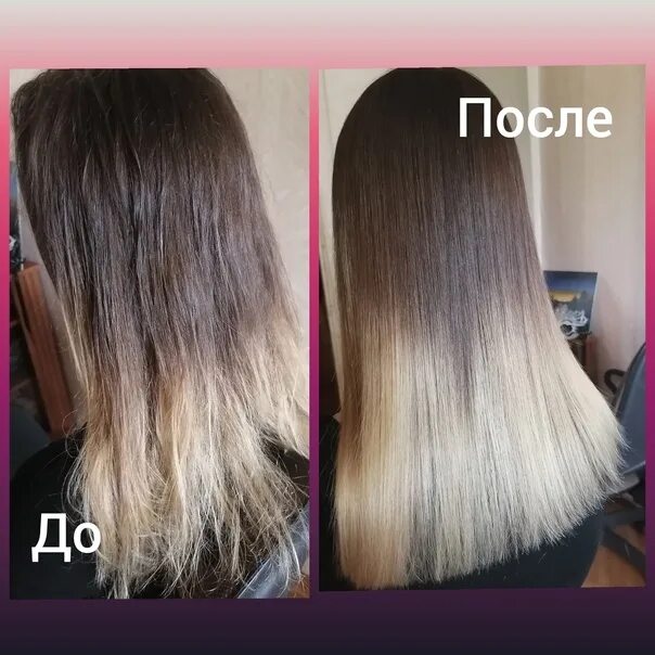 Волосы после короны. Волосы после короны. После короны выпадают волосы форум. Здоровые волосы. Реактивное выпадение волос.