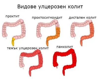 Колем или