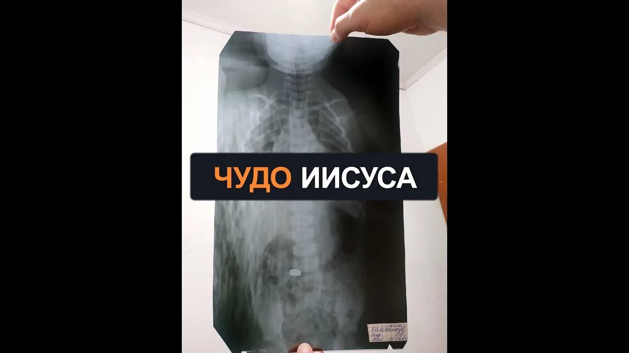 Ребенок проглотил батарейку. Проглотил пальчиковую батарейку. что будет если ребенок проглотил батарейку. если ребёнок проглотил батарейку пальчиковую. как понять что ребенок съел батарейку.