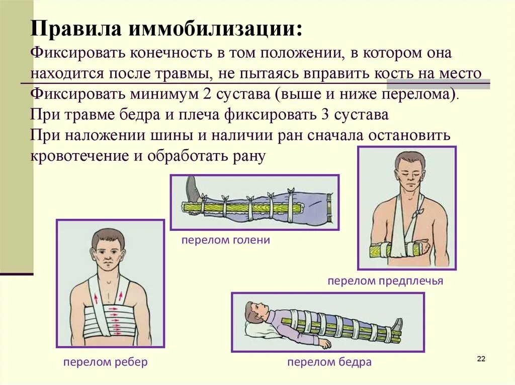 1 помощь при переломе верхней конечности. Транспортная иммобилизация при переломах костей. Транспортная иммобилизация костей нижних конечностей алгоритм. Иммобилизация поврежденной конечности при переломах. Транспортная иммобилизация при переломе верхней конечности и нижней.