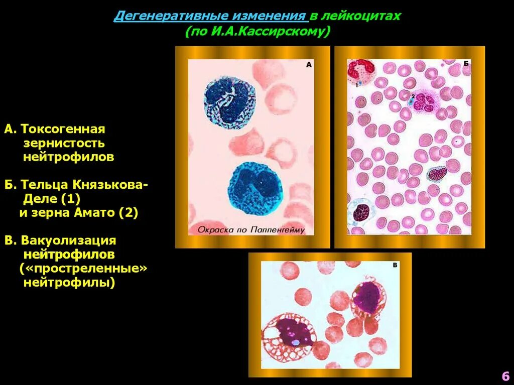 Изменения лейкоцитов в крови