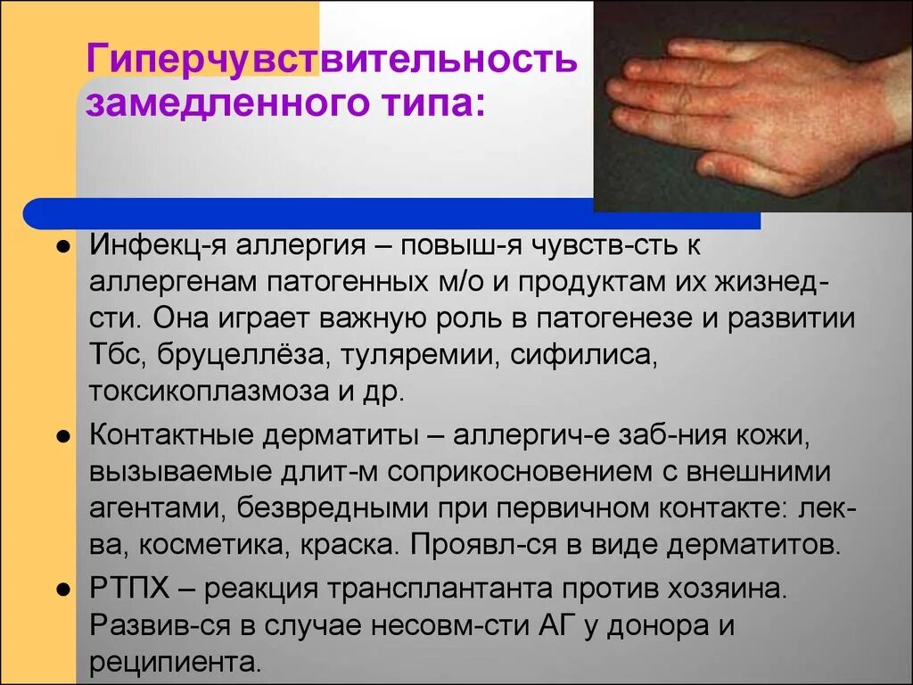 Гиперчувствительность замедленного типа. Гиперчувсивиткльность зпмедленного тира. Реакция гиперчувствительности замедленного типа. Гиперчувствительность замедленного типа (ГЗТ). Повышенная чувствительность латынь