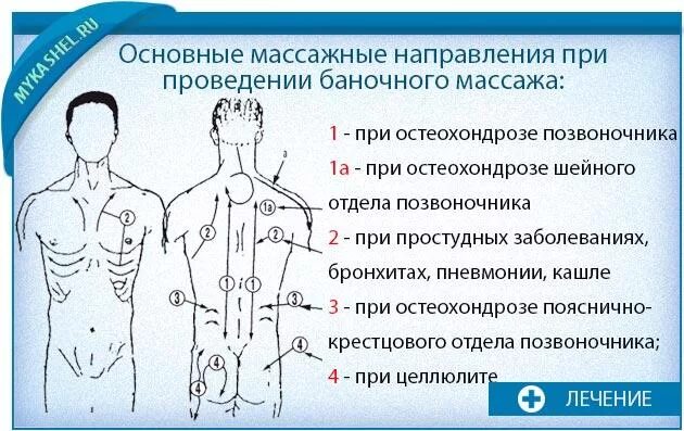 Точки после массажа. Как правильно устанавливать вакуумные банки. Вакуумные банки схема постановки на спине. Баночный массаж спины схема. Куда ставить вакуумные банки на спину схема.