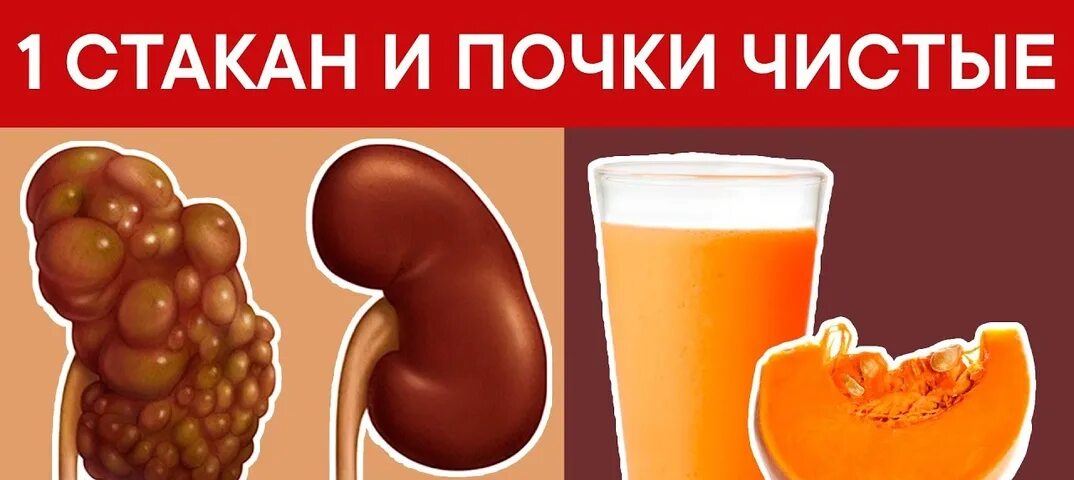 Что полезно для почек. Продукты вредные для почек. Полезные продукты для поче. Что вредно для почек. Что вредит почкам.
