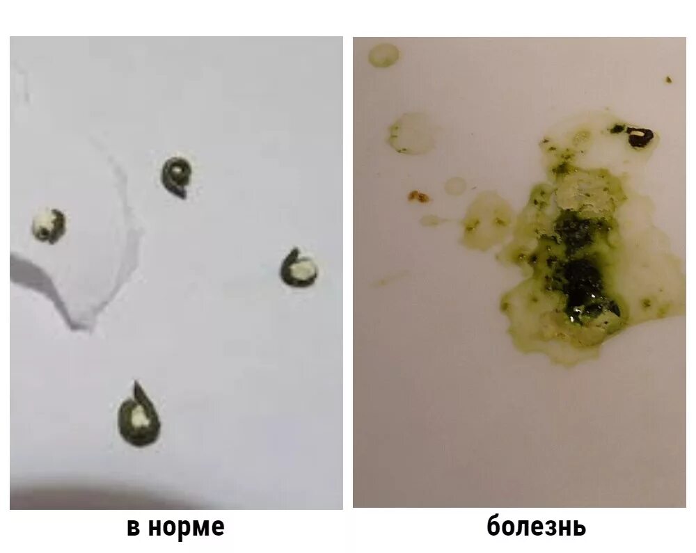 Какашки птиц. Жидкий помет у волнистого попугая. Помет волнистого попугая. Помет волнистого попугая норма. Зеленый помоет у попугая.