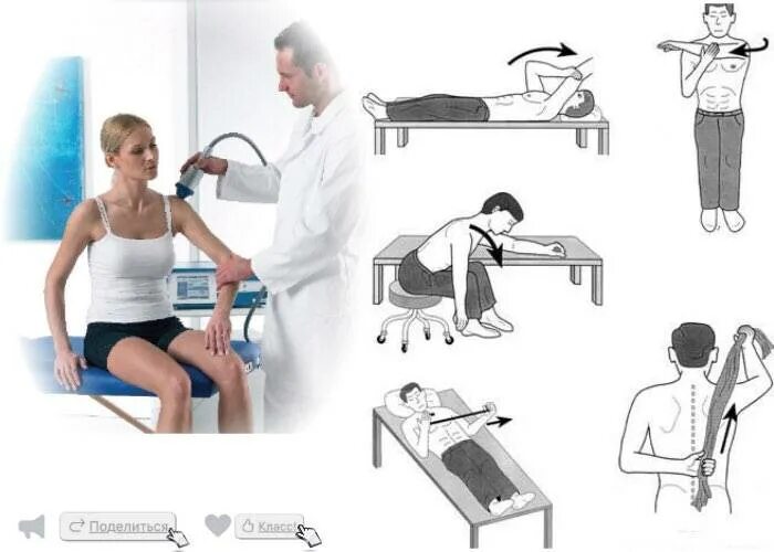 Лечебная гимнастика при периартрите плечевого сустава. Плечелопаточный периартрит (плечевой синдром),. Постизометрическая релаксация при плечелопаточном периартрите. ЛФК при плечелопаточном периартрите упражнения. Эффективное лечение плечевого сустава