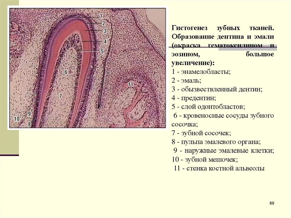 Стадии развития зуба. Гистогенез зуба гистология. Дентин препарат гистология. Дентинные канальцы гистология.