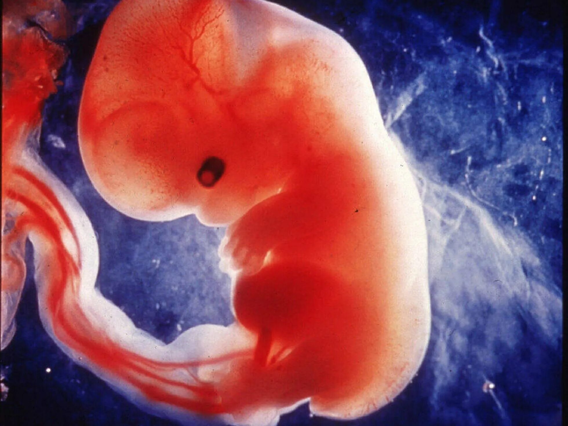 Как выглядит эмбрион 7 недель фото: найдено 90 изображений