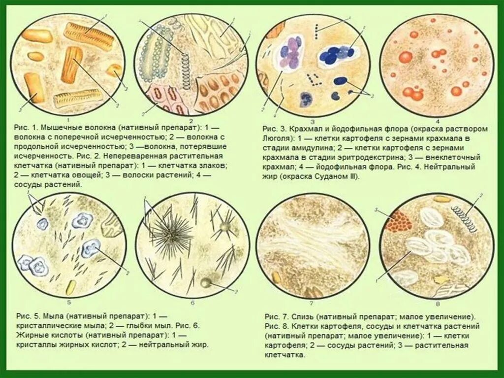 Простейшие в кале лечение. Микроскопия кала растительная клетчатка непереваримая. Копрологическое исследование микроскопия препаратов кала. Атлас копрограмма микроскопия. Микроскопия нативного препарата кала.