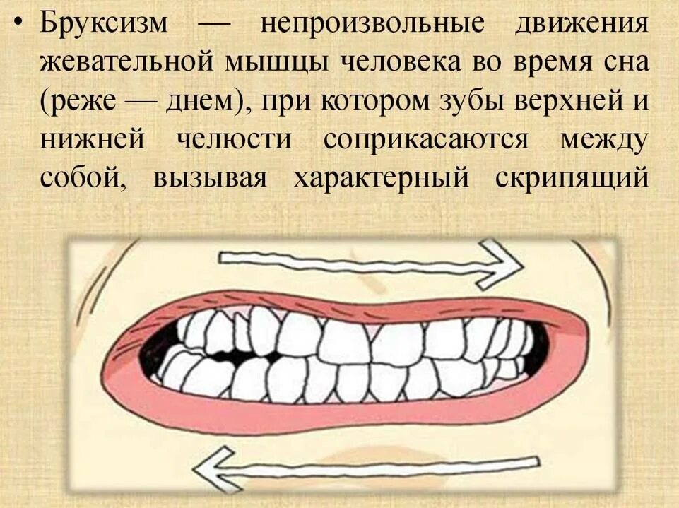 Почему щелкает зуб. Человек скрипит зубами во сне. Скрежет зубами во сне причины.