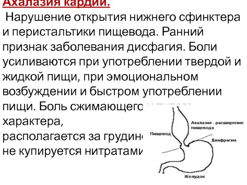 Нарушение перистальтики пищевода. Нарушение моторики пищевода. Нижний пищеводный сфинктер. Повышение тонуса Нижнего пищеводного сфинктера. Почему сфинктер