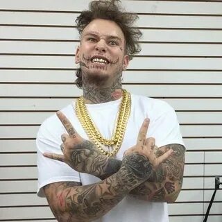 Stitches на русском