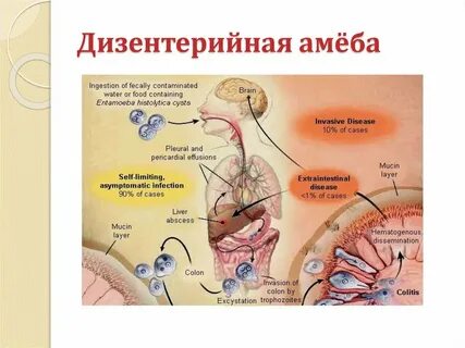 Дизентерийная амеба образует в стенке кишечника
