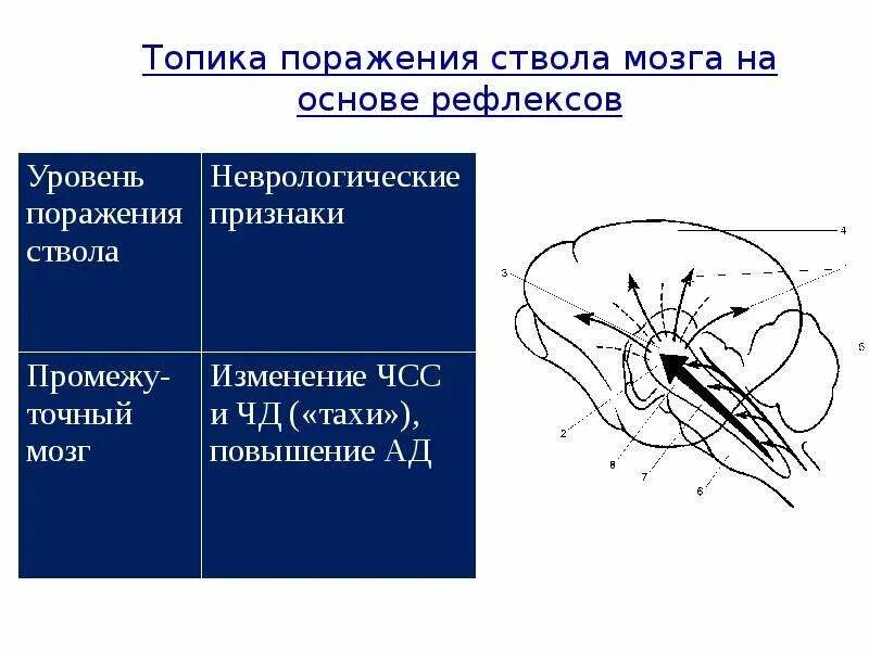 Поражение ствола головного. Познотонические рефлексы ствола мозга. Топика поражения ствола мозга. Поражение ствола мозга симптомы. Ствол мозга поражение на разных уровнях.