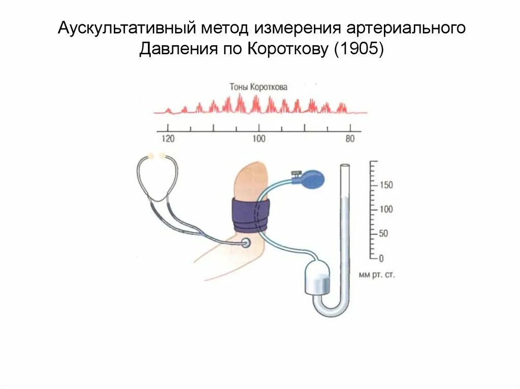 Давление биология 8 класс. Артериальное давление методом Короткова. Метод Короткова для измерения артериального давления. Измерение кровяного давления методом Короткова. Аускультативный метод измерения ад (метод Короткова).