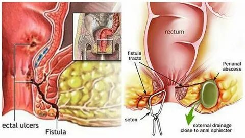 Инцест бейнеленген орыс секс бейнелері