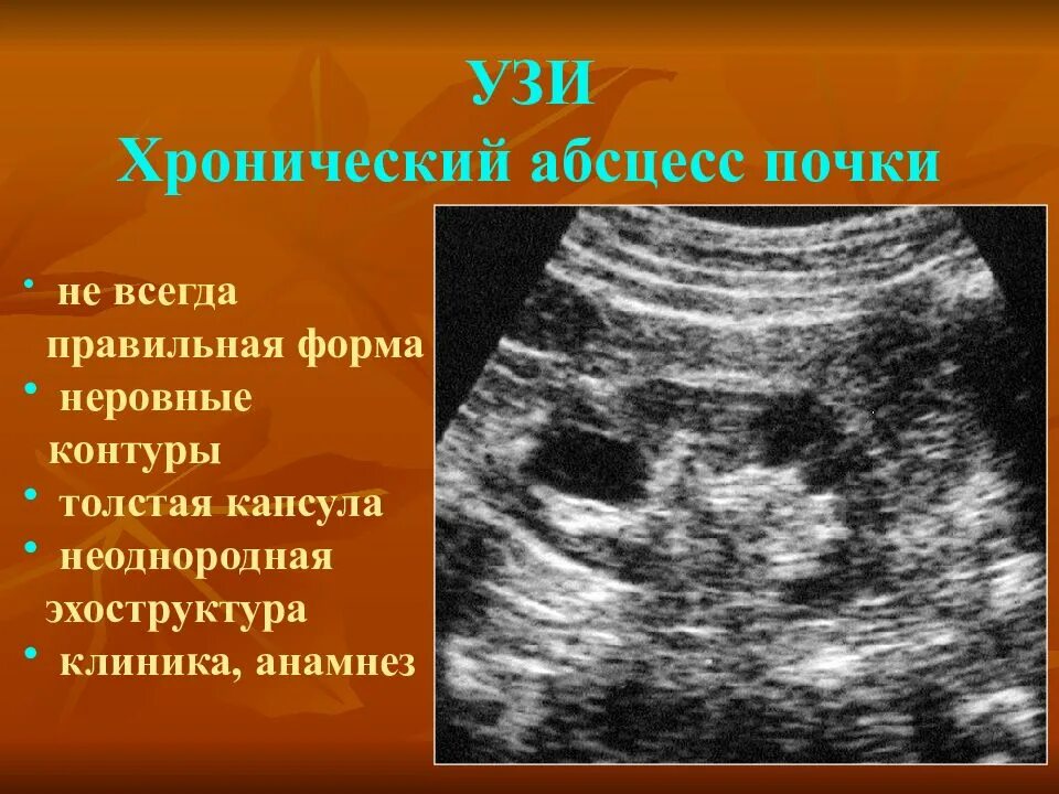 Узи эхоструктура неоднородная. Узи эхоструктура неоднородная. Узи эхоструктура неоднородная. Неоднородная структура поджелудочной железы на узи. Жировая инфильтрация печени на узи.