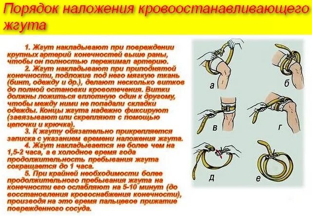 Жгут ослабляем через какое время