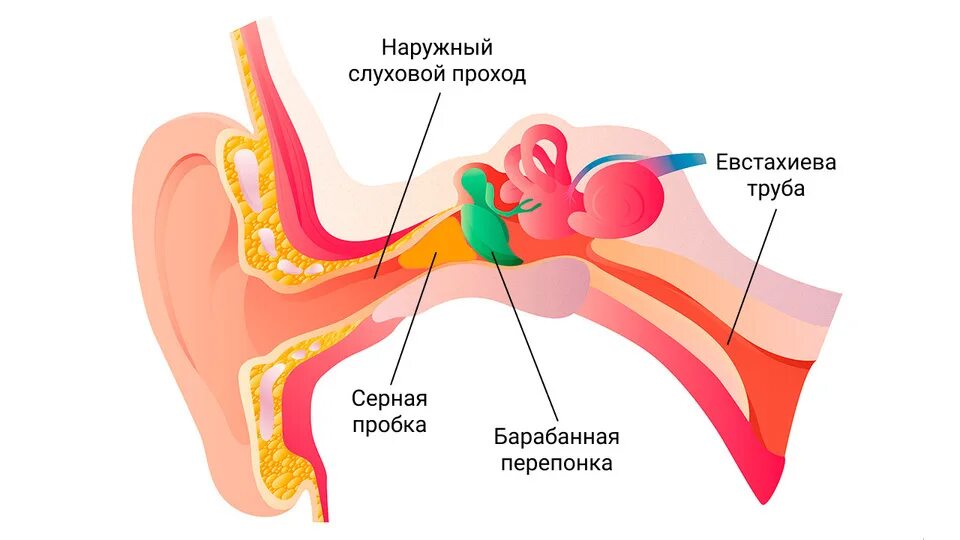 Как прочистить ухо от серной пробки. Строение уха человека сера. строение уха человека с серной пробкой. строение уха человека серная пробка. строение человеческого уха серная пробка.