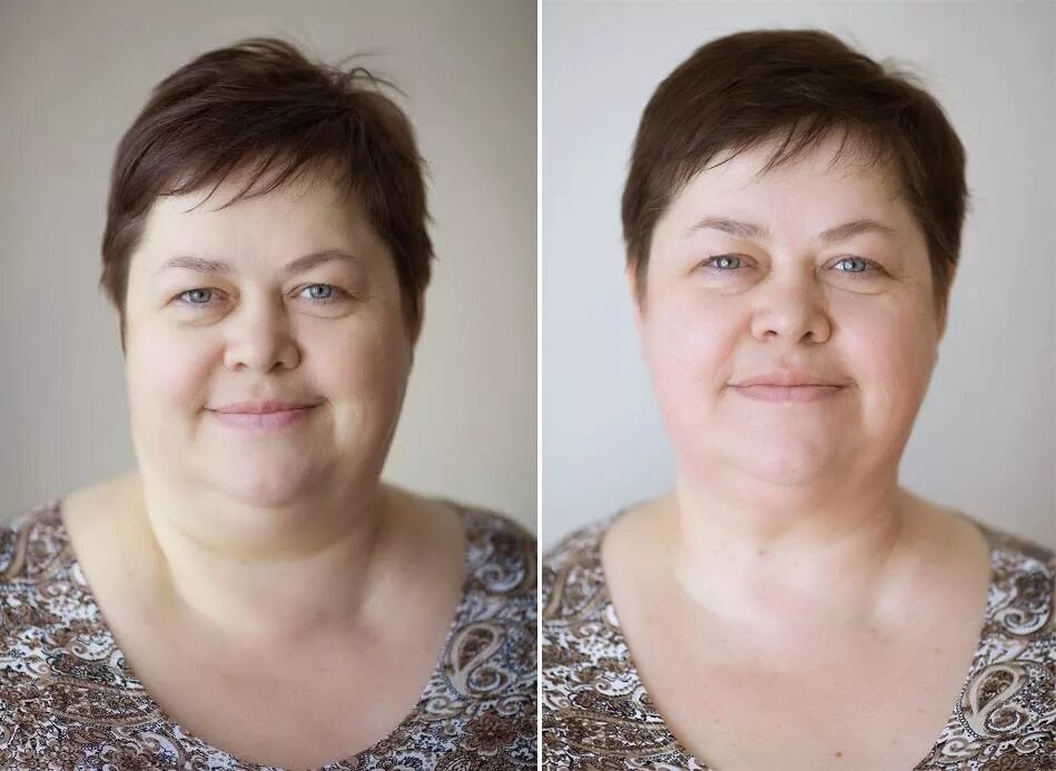 Авиаторы толстое лицо. Кожа стала жирной после 45 лет. Лиопотик для лица жирных. Изменения после 45