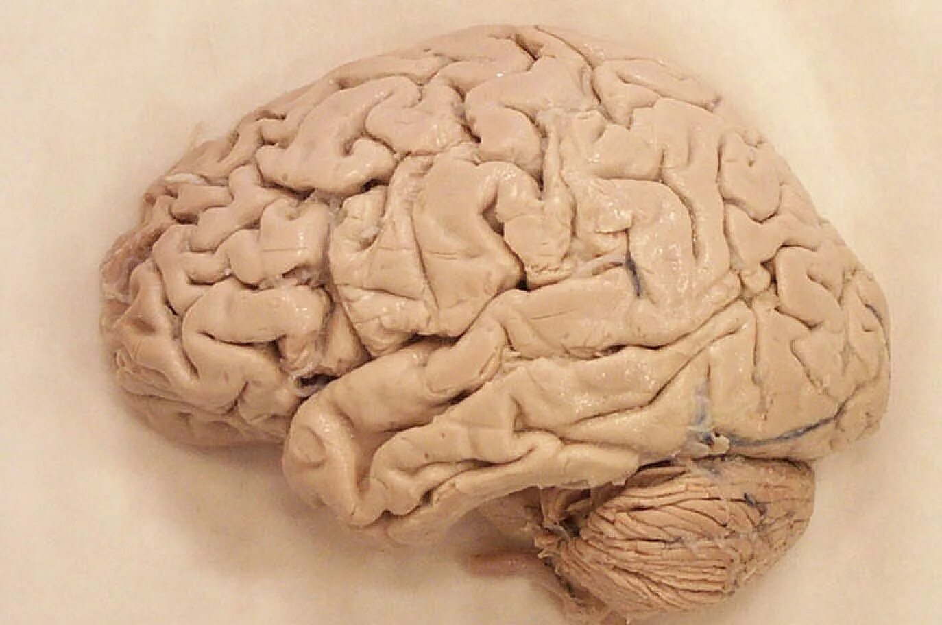 Настоящий человеческий мозг.