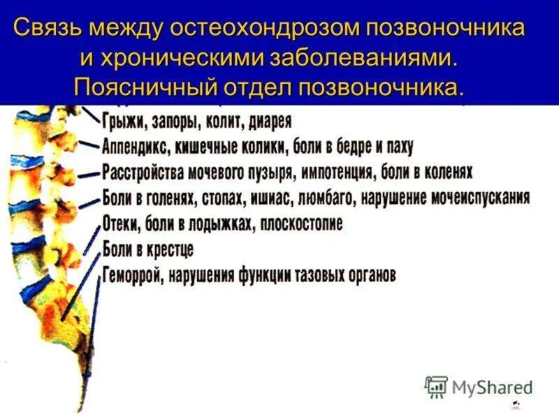 Как лечить поясничного отдела позвоночника. Проявления поясничного остеохондроза. Поясничный остеохондроз симптомы. Признаки остеохондроза поясничного отдела. Остеохондроз поясничного отдела позвоночника симптомы.