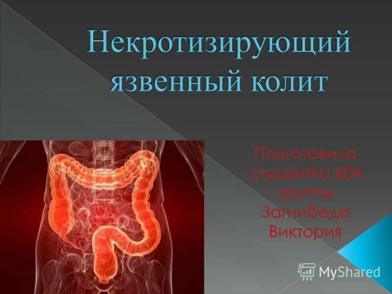 заболевания нервной системы. воспалительные заболевания центр. корниенко е. воспалительные заболевания центральной нервной системы. классификация инфекционных заболеваний цнс.