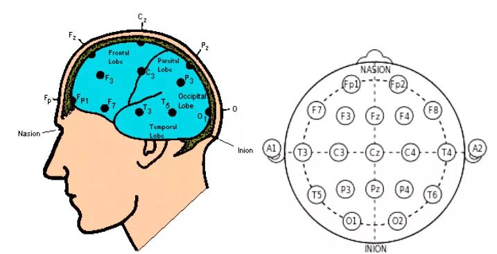 Система ээг. Схема расположения электродов 10-20 ЭЭГ. Точки наложения электродов при ЭЭГ. Схема наложения электродов при ЭЭГ. Схема 10-20 наложение электродов.