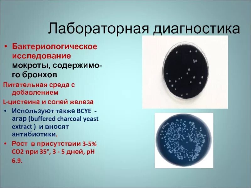 Лабораторное исследование мокроты. Бактериологическое исследование мокроты. Бактериологический анализ мокроты. Лабораторные методы исследования мокроты.