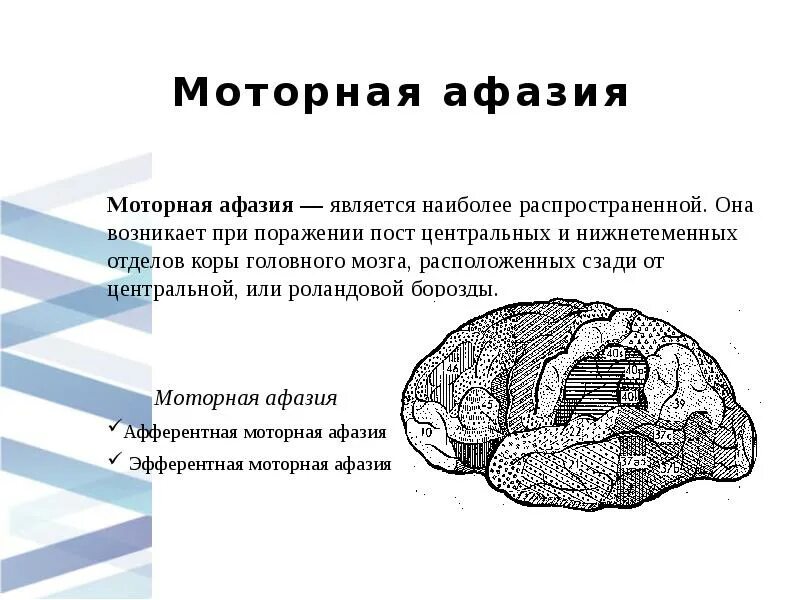 Теменные формы афазии. Моторная афазия возникает при поражении. афазия развивается при поражении. афазия неврология. поражение мозга при моторной афазии.