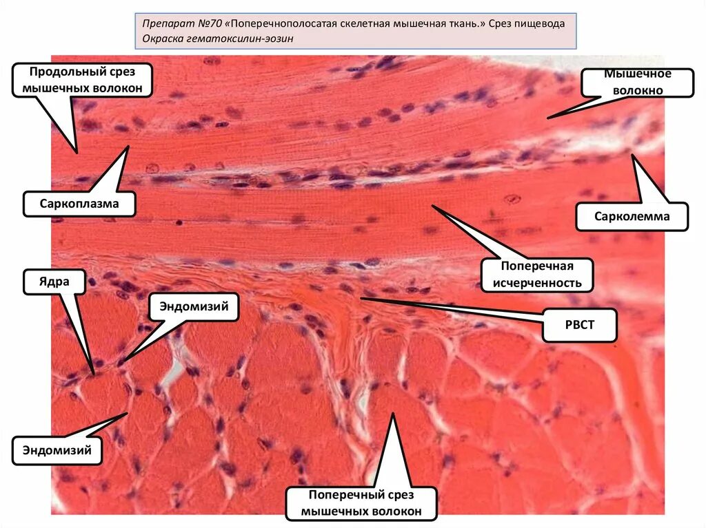 Поперечнополосатая Скелетная мышечная ткань препарат. Скелетная мышечная ткань гистология препарат. Строение поперечно полосатой мышечной ткани гистология. Скелетная поперечно-полосатая мышечная ткань продольный срез. Препарат поперечно полосатая мышечная ткань