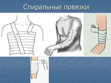 Повязки на туловище