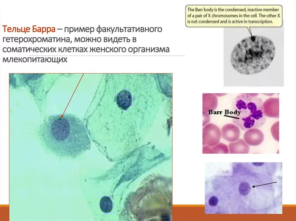 Половой хроматин тельца Барра. Тельца Барра под микроскопом. Тельца Барра в микроскопе. Тельце Барра в микроскопе. Синдром тельце