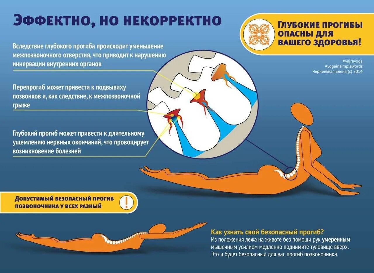Прогиб позвоночника. Прогиб позвоночника в пояснице. Опасные прогибы в пояснице. Опасные упражнения для поясницы.