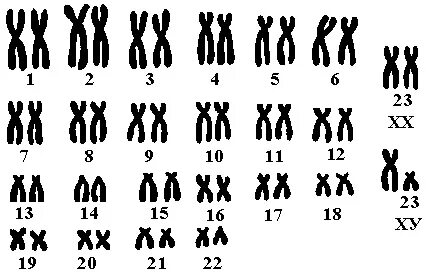 В кариотипе яблони 34
