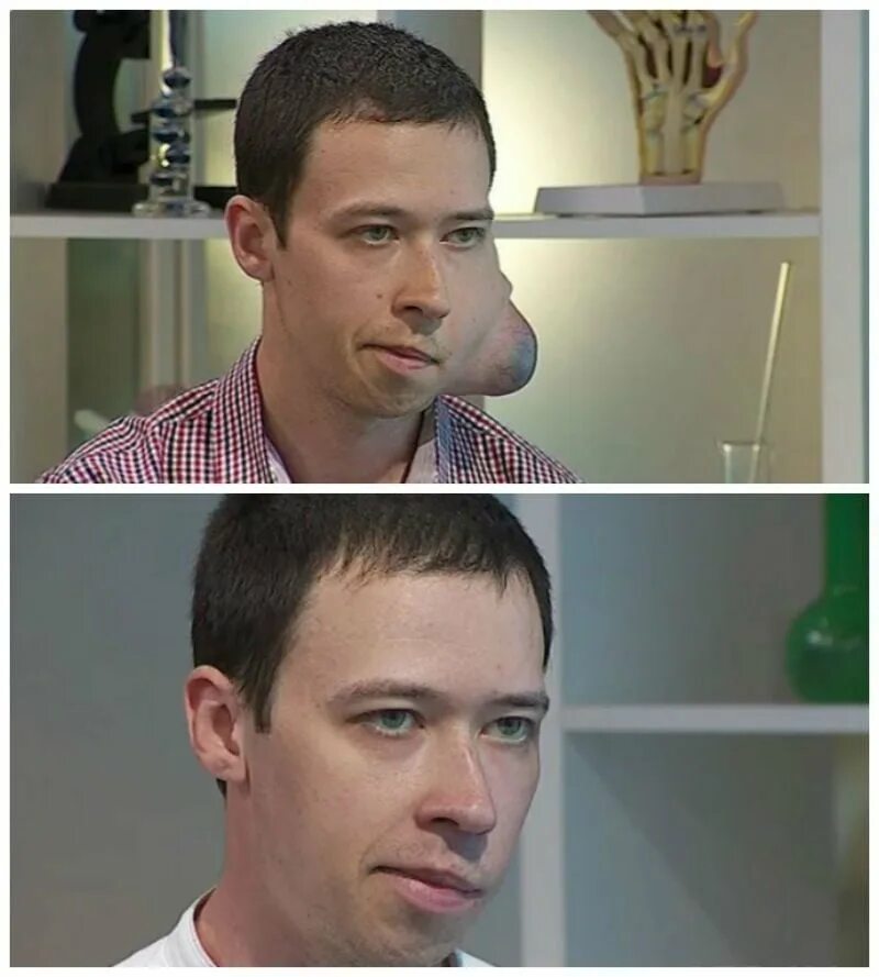 Я стесняюсь своего тела до и после. Сергей тесленко я стесняюсь своего тела. Стесняюсь своего тела челюсть. Я стесняюсь своего тела россия до и после. Светлана савченкова.