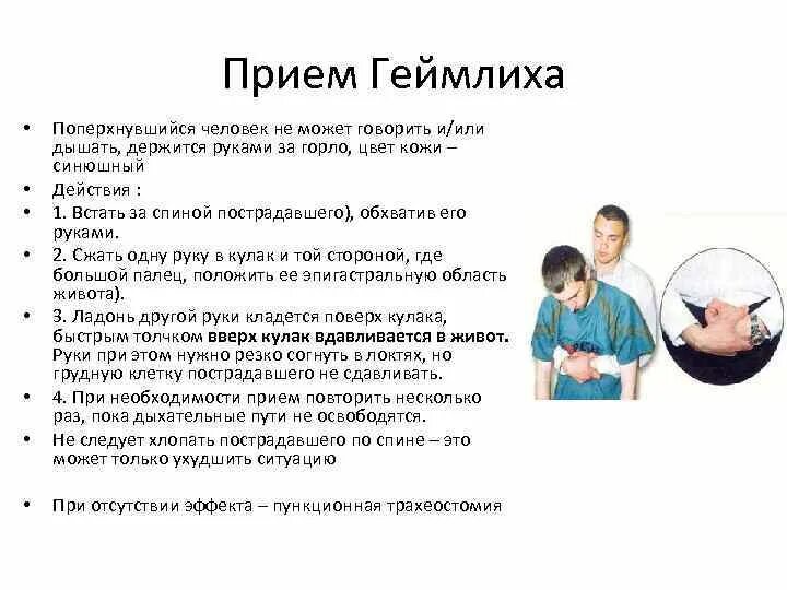 Приём Геймлиха техника выполнения. Прием Геймлиха алгоритм выполнения. Приём Хаймлиха Геймлиха.