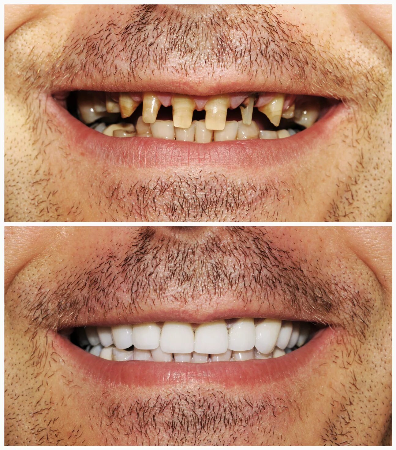 Зубы после 30