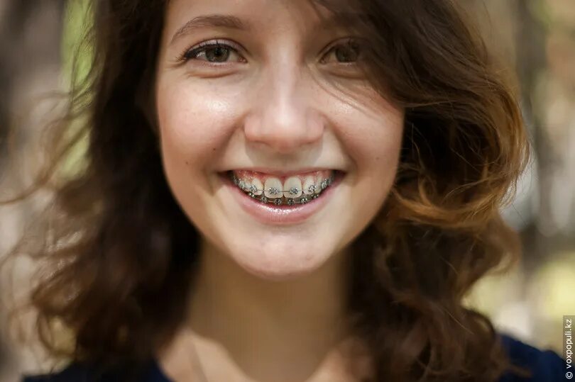 Брижит зубы. Ровные зубы. Зубы в 30 лет. Зубы в 30 лет. Брекеты взрослому человеку.