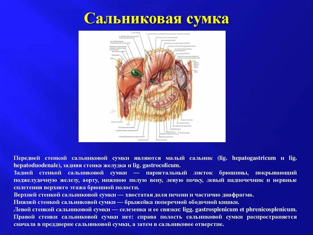 Винслово отверстие. Сальниковая сумка топографическая анатомия стенки. Сальниковое отверстие сальниковой сумки. Сальниковая сумка брюшины стенки. Топографическая анатомия сальниковой сумки.