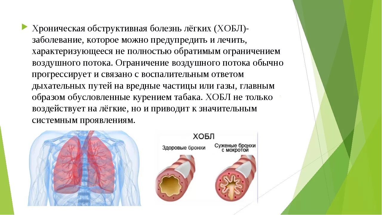 Хроническая обструктивная болезнь легких. Полость заболевания легких